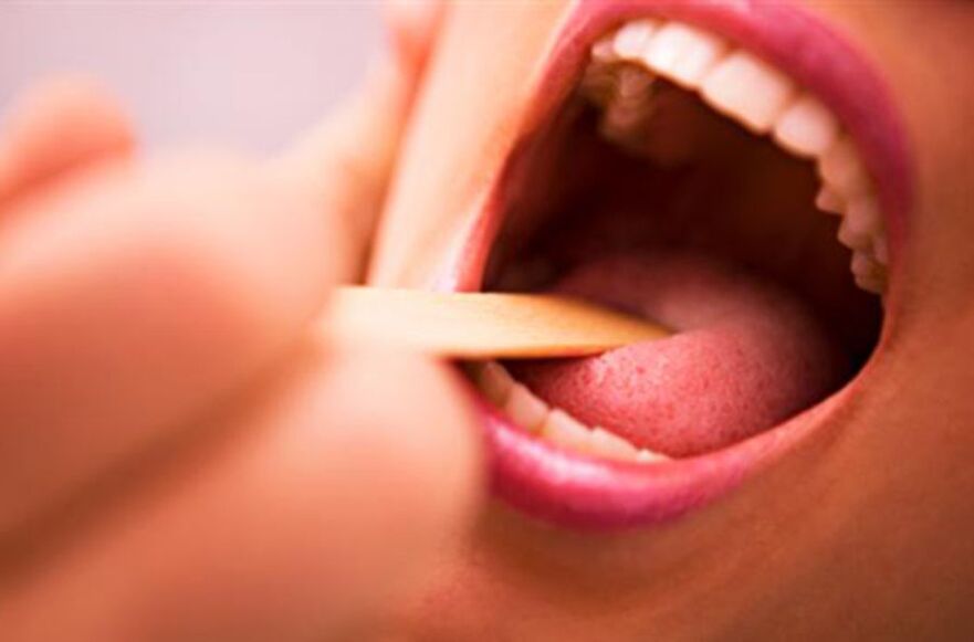 parasiitide tüübid inimese suus